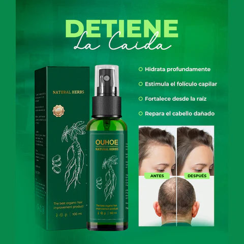 OUHOE RevitaHair™ 💎 | Nutrición y Crecimiento Capilar Exprés